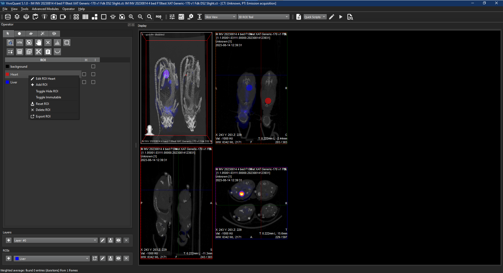 Image of VivoQuant UI: 3D ROI view of individual ROI options