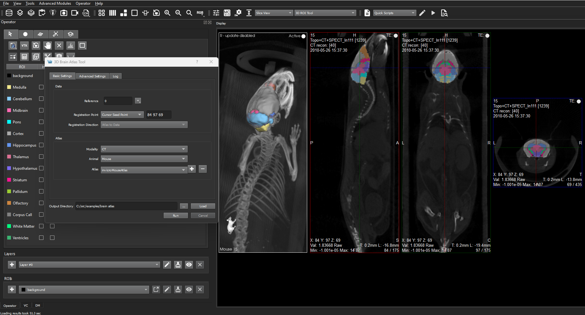 Image of VivoQuant UI: Brain Atlas in use with new Cursor Seed point option