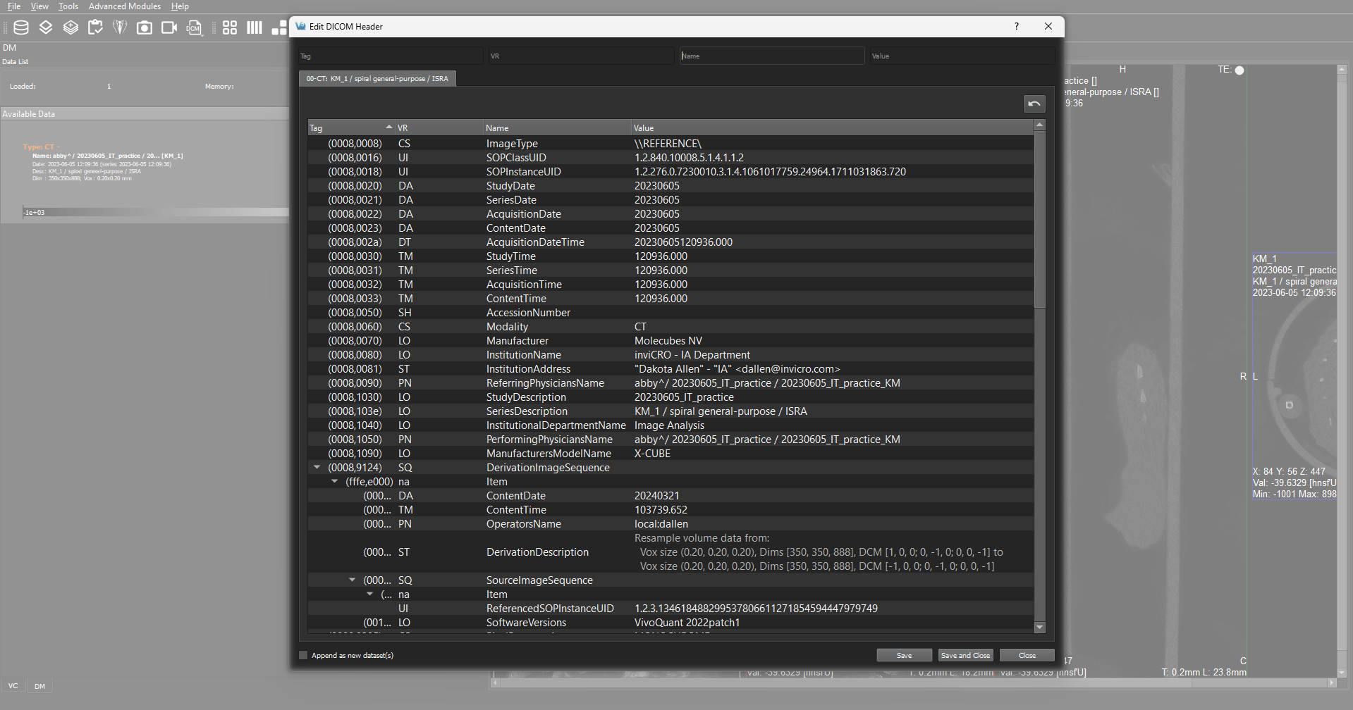Image of VivoQuant UI: Dedicated DICOM Editor