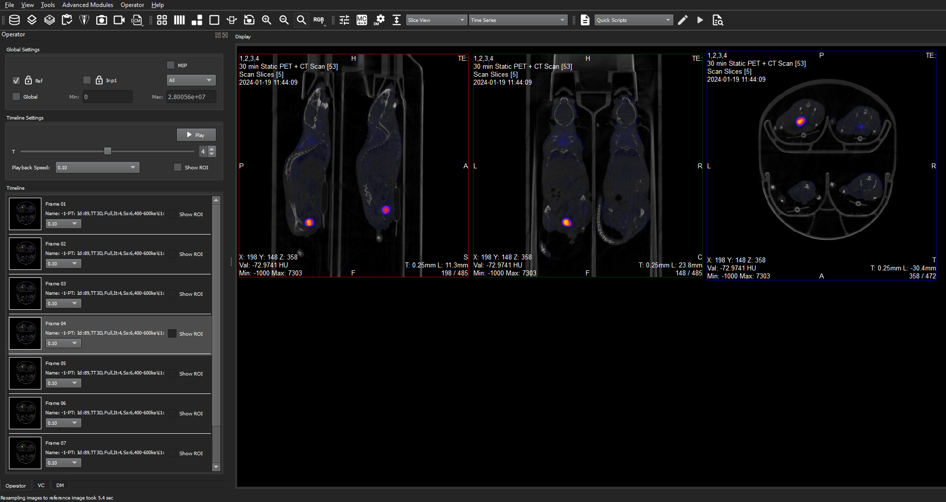 Image of VivoQuant UI: Time Series Operator