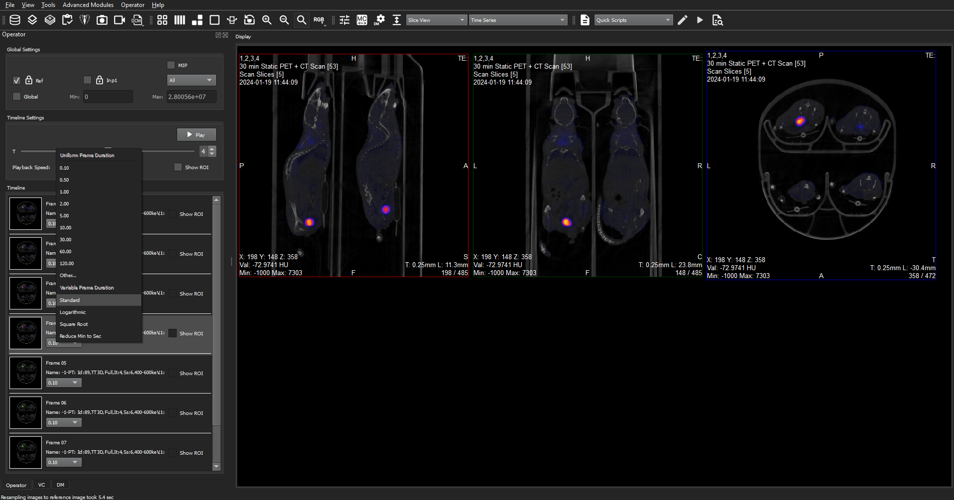 Image of VivoQuant UI: Time Series Operator with duration options dropdown shown