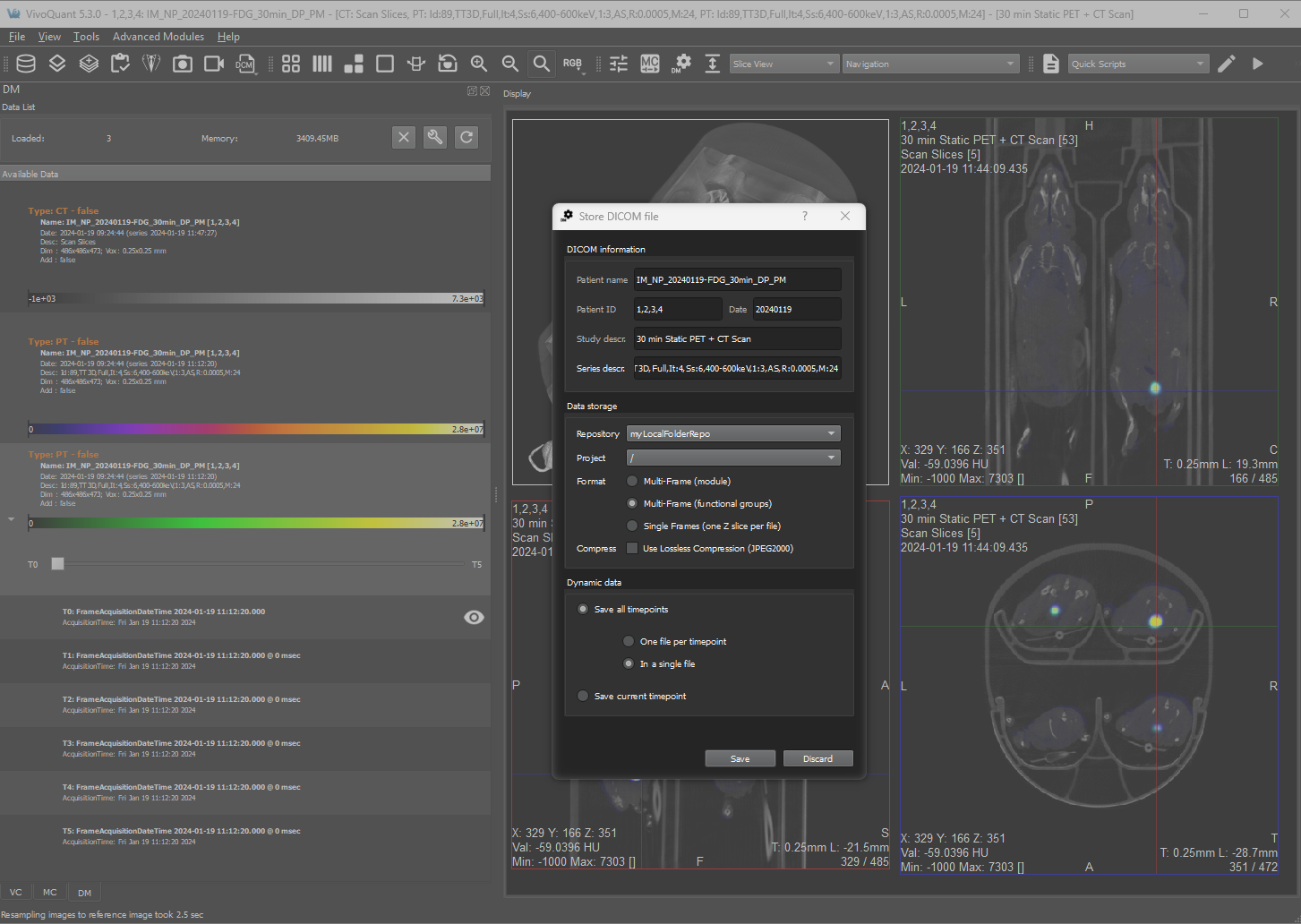 Image of VivoQuant UI: Saving Options