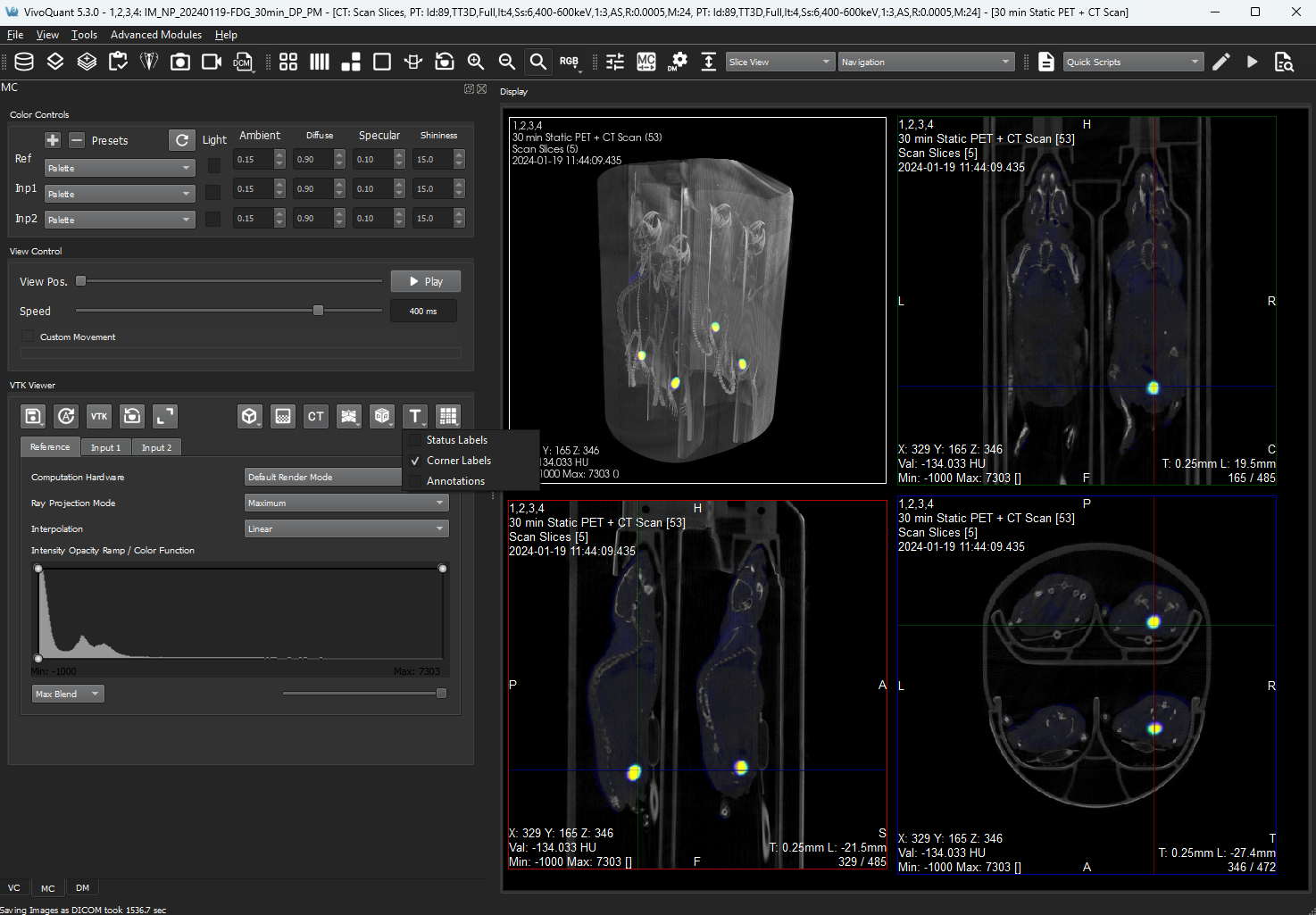 Image of VivoQuant UI: Labeling options shown on MIP Control