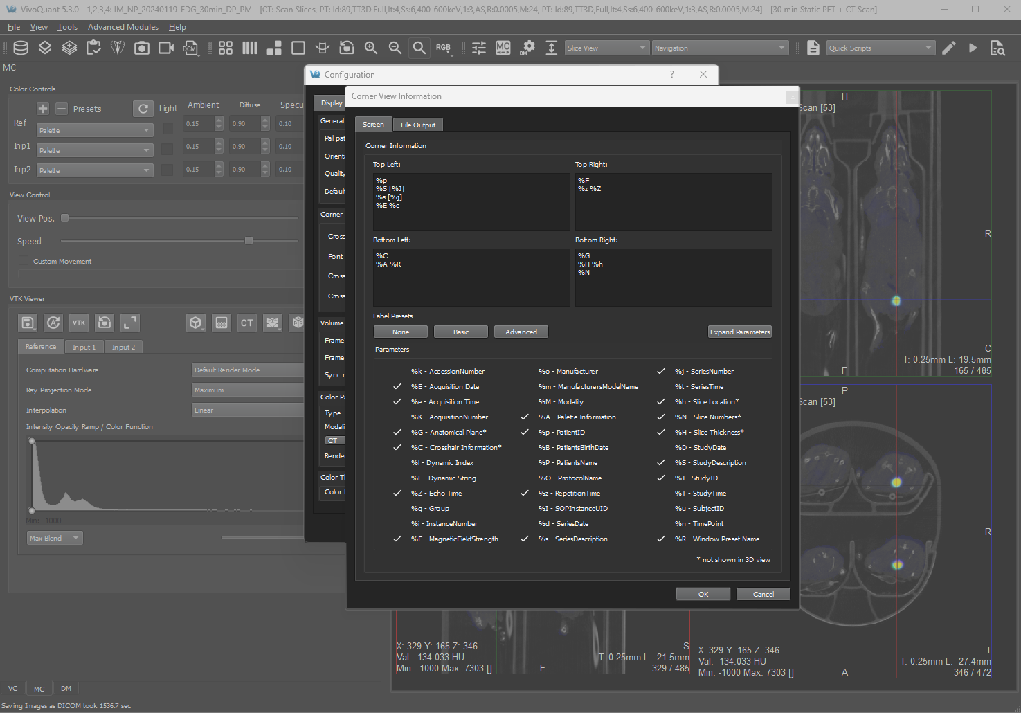 Image of VivoQuant UI: Corner Info Labeling